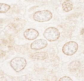Immunohistochemistry (Formalin/PFA-fixed paraffin-embedded sections) - Anti-WDFY3 antibody (AB84888)