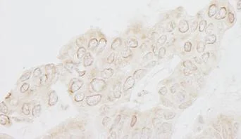 Immunohistochemistry (Formalin/PFA-fixed paraffin-embedded sections) - Anti-WDFY3 antibody (AB84888)