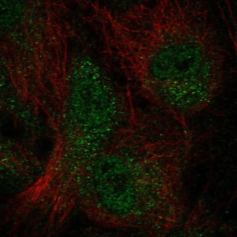 Immunocytochemistry/ Immunofluorescence - Anti-WDFY4 antibody (AB122661)