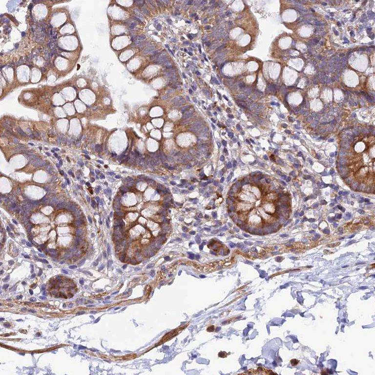 Immunohistochemistry (Formalin/PFA-fixed paraffin-embedded sections) - Anti-WDFY4 antibody (AB122661)