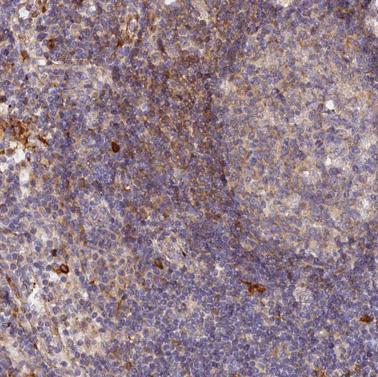 Immunohistochemistry (Formalin/PFA-fixed paraffin-embedded sections) - Anti-WDFY4 antibody (AB122661)