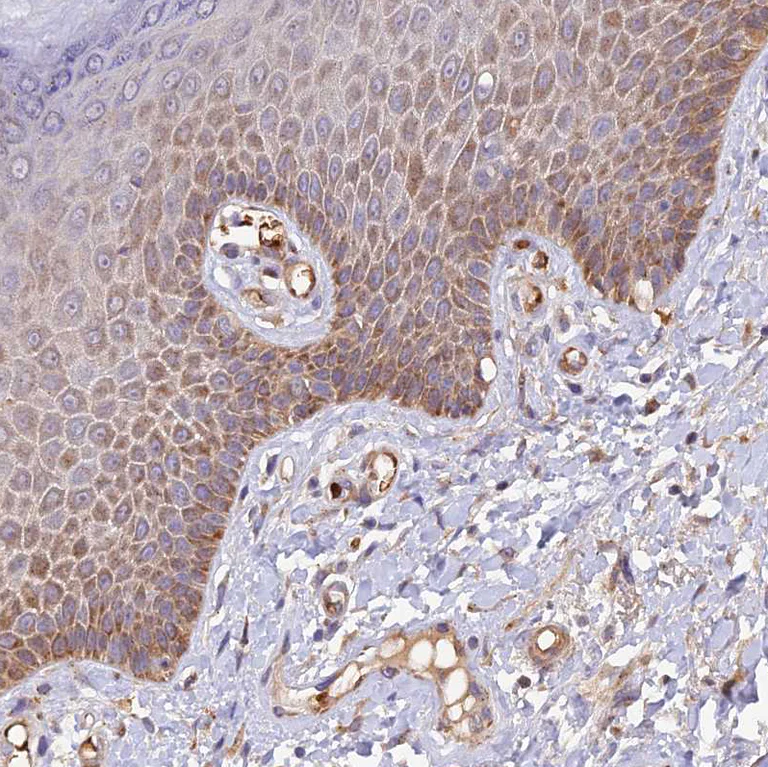 Immunohistochemistry (Formalin/PFA-fixed paraffin-embedded sections) - Anti-WDFY4 antibody (AB122661)