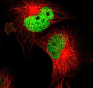 Immunocytochemistry/ Immunofluorescence - Anti-WDHD1 antibody (AB224221)