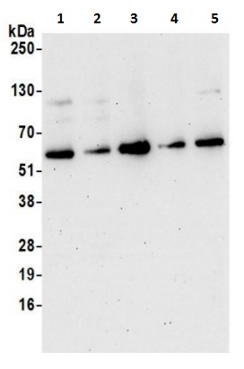 Western blot - Anti-WDR1 antibody (AB241207)