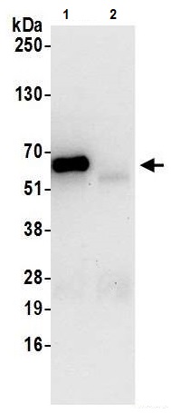 Immunoprecipitation - Anti-WDR1 antibody (AB241366)