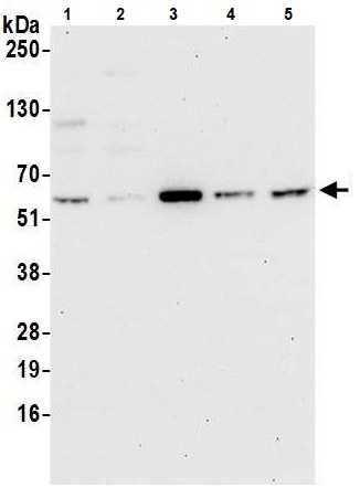 Western blot - Anti-WDR1 antibody (AB241366)