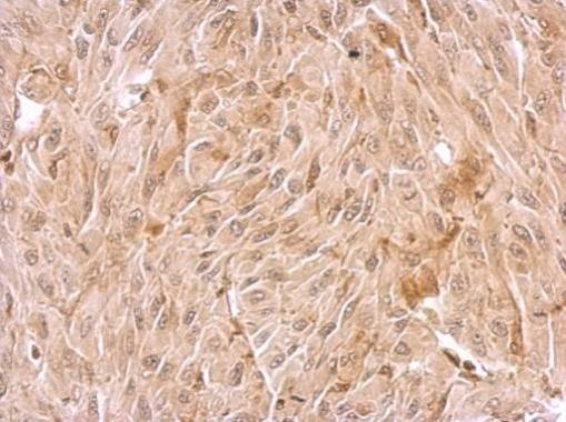 Immunohistochemistry (Formalin/PFA-fixed paraffin-embedded sections) - Anti-WDR1 antibody - C-terminal (AB228738)