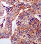 Immunohistochemistry (Formalin/PFA-fixed paraffin-embedded sections) - Anti-WDR1 antibody [EPR8793] (AB173574), expandable thumbnail