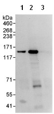 Immunoprecipitation - Anti-WDR11 antibody (AB93871)
