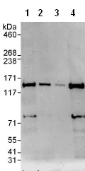 Western blot - Anti-WDR11 antibody (AB93871)
