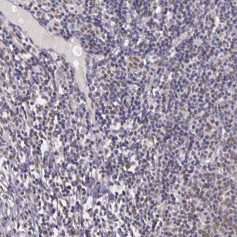 Immunohistochemistry (Formalin/PFA-fixed paraffin-embedded sections) - Anti-WDR13 antibody (AB272543)
