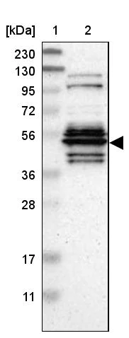 Western blot - Anti-WDR13 antibody (AB272543)