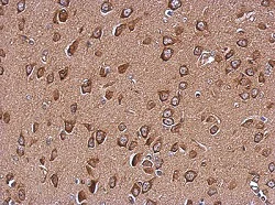 Immunohistochemistry (Formalin/PFA-fixed paraffin-embedded sections) - Anti-WDR16 antibody (AB127559)