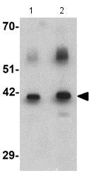 Western blot - Anti-WDR18 antibody (AB176261)