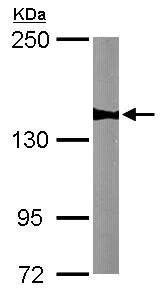 Western blot - Anti-WDR19 antibody (AB105044)