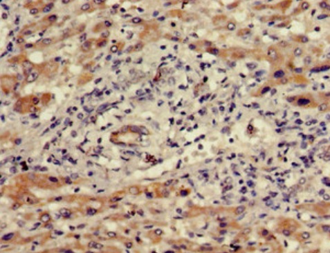 Immunohistochemistry (Formalin/PFA-fixed paraffin-embedded sections) - Anti-WDR19 antibody (AB222908), expandable thumbnail
