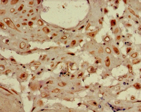 Immunohistochemistry (Formalin/PFA-fixed paraffin-embedded sections) - Anti-WDR19 antibody (AB222908), expandable thumbnail