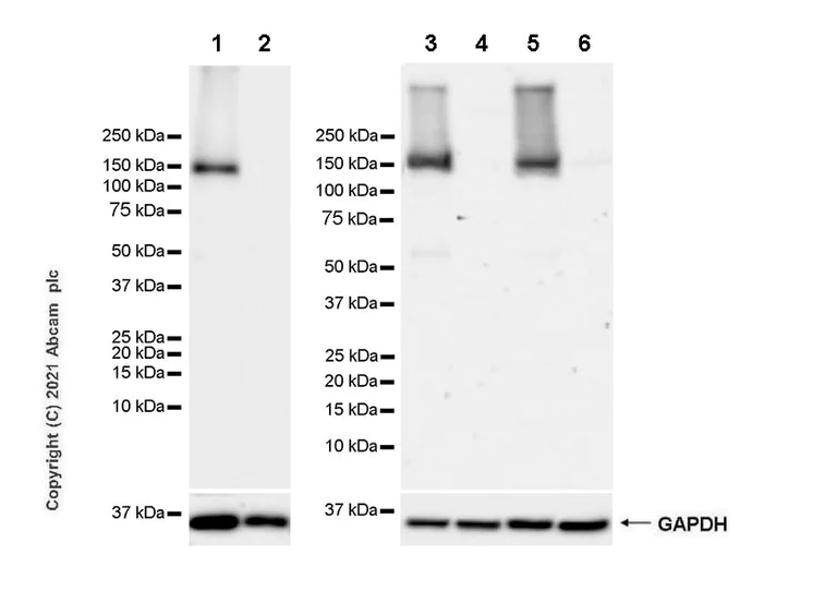 Western blot - Anti-WDR19 antibody [EPR24915-11] - BSA and Azide free (AB283709)