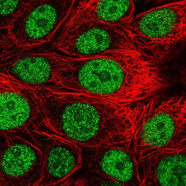 Immunocytochemistry/ Immunofluorescence - Anti-WDR21A antibody (AB130417), expandable thumbnail