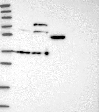Western blot - Anti-WDR21A antibody (AB130417)