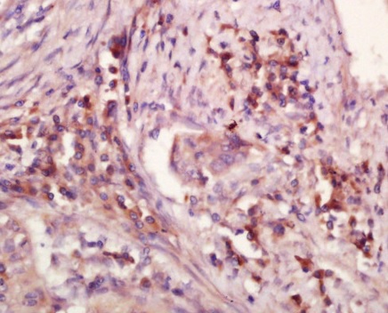 Immunohistochemistry (Formalin/PFA-fixed paraffin-embedded sections) - Anti-WDR26 antibody (AB203345), expandable thumbnail