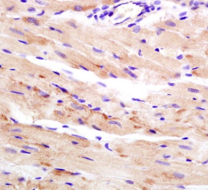 Immunohistochemistry (Formalin/PFA-fixed paraffin-embedded sections) - Anti-WDR26 antibody (AB203345), expandable thumbnail