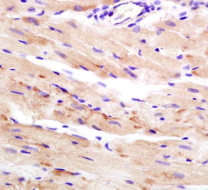 Immunohistochemistry (Formalin/PFA-fixed paraffin-embedded sections) - Anti-WDR26 antibody (AB203345)