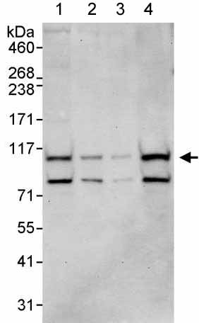 Western blot - Anti-WDR3 antibody (AB176817)