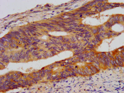 Immunohistochemistry (Formalin/PFA-fixed paraffin-embedded sections) - Anti-WDR37 antibody (AB235046)