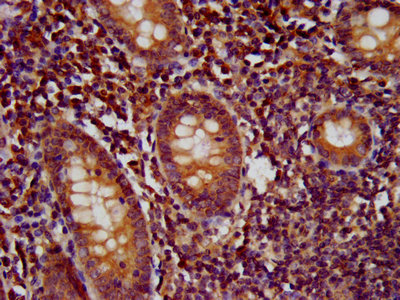 Immunohistochemistry (Formalin/PFA-fixed paraffin-embedded sections) - Anti-WDR37 antibody (AB235046)