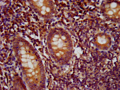 Immunohistochemistry (Formalin/PFA-fixed paraffin-embedded sections) - Anti-WDR37 antibody (AB235046)