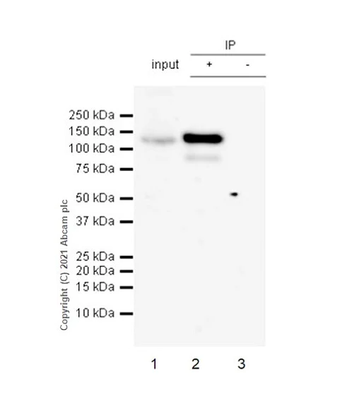 Immunoprecipitation - Anti-WDR41 antibody [EPR26180-218] - BSA and Azide free (AB314861)