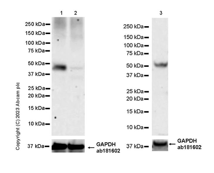 Western blot - Anti-WDR41 antibody [EPR26180-218] - BSA and Azide free (AB314861)