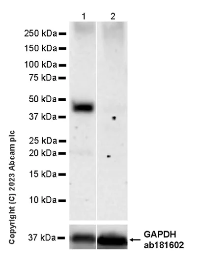 Western blot - Anti-WDR41 antibody [EPR26180-218] - BSA and Azide free (AB314861)