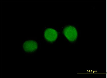 Immunocytochemistry/ Immunofluorescence - Anti-WDR45 antibody (AB168532), expandable thumbnail