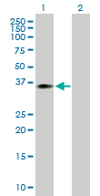 Western blot - Anti-WDR45 antibody (AB168532), expandable thumbnail