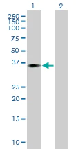 Western blot - Anti-WDR45 antibody (AB168532)