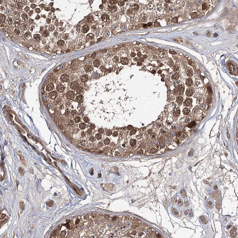 Immunohistochemistry (Formalin/PFA-fixed paraffin-embedded sections) - Anti-WDR48/UAF1 antibody (AB122473)