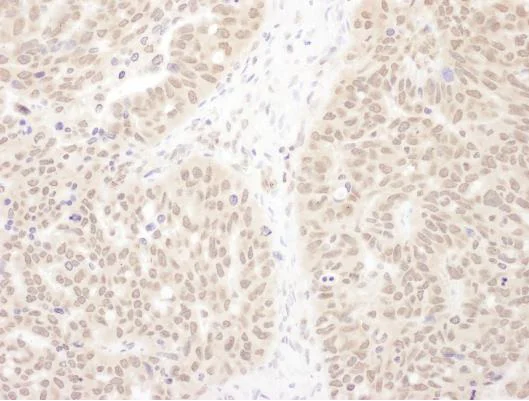 Immunohistochemistry (Formalin/PFA-fixed paraffin-embedded sections) - Anti-WDR5 antibody (AB245479)