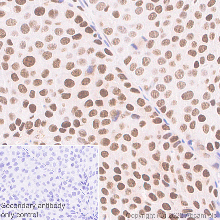 Immunohistochemistry (Formalin/PFA-fixed paraffin-embedded sections) - Anti-WDR5 antibody [EPR27033-6] (AB307664)