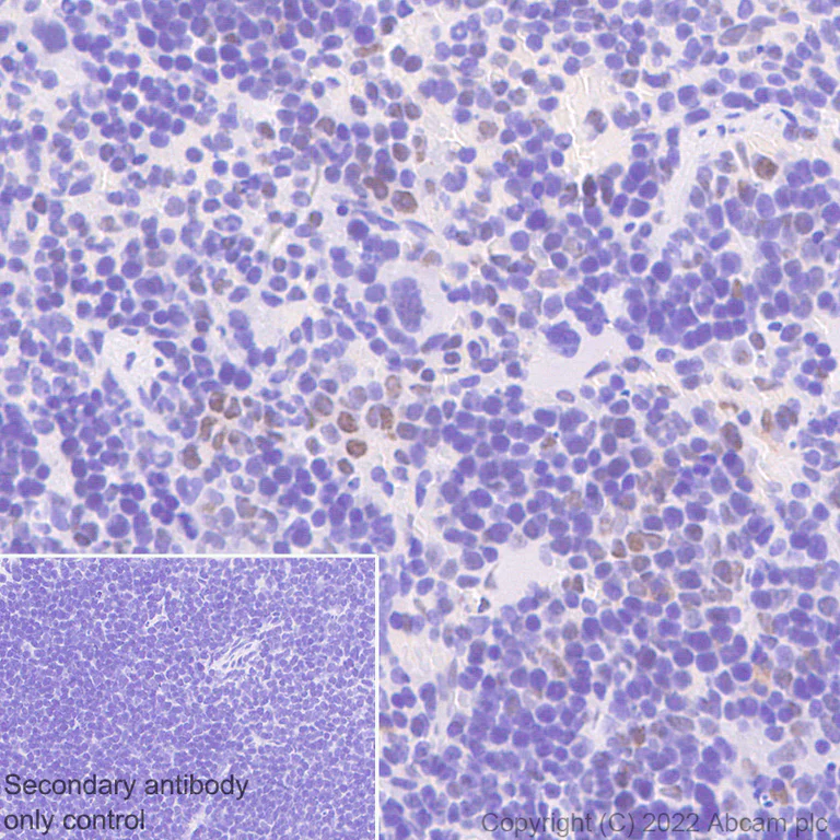 Immunohistochemistry (Formalin/PFA-fixed paraffin-embedded sections) - Anti-WDR5 antibody [EPR27033-6] (AB307664)