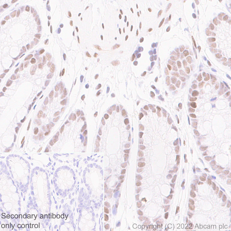 Immunohistochemistry (Formalin/PFA-fixed paraffin-embedded sections) - Anti-WDR5 antibody [EPR27033-6] (AB307664)
