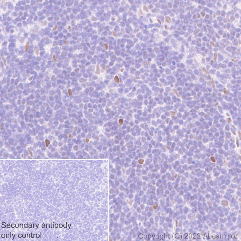 Immunohistochemistry (Formalin/PFA-fixed paraffin-embedded sections) - Anti-WDR5 antibody [EPR27033-6] (AB307664)