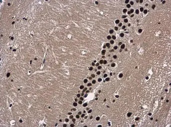 Immunohistochemistry (Formalin/PFA-fixed paraffin-embedded sections) - Anti-WDR62 antibody (AB154044)