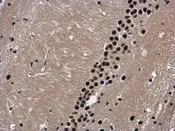 Immunohistochemistry (Formalin/PFA-fixed paraffin-embedded sections) - Anti-WDR62 antibody (AB154044)