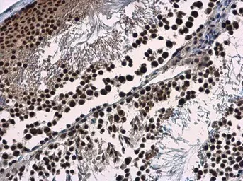Immunohistochemistry (Formalin/PFA-fixed paraffin-embedded sections) - Anti-WDR62 antibody (AB154044)