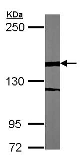 Western blot - Anti-WDR62 antibody (AB154044), expandable thumbnail