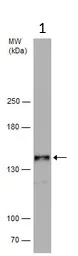 Western blot - Anti-WDR62 antibody (AB154044)