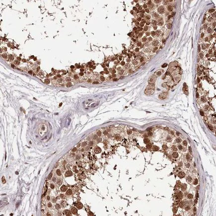 Immunohistochemistry (Formalin/PFA-fixed paraffin-embedded sections) - Anti-WDR63 antibody (AB216126)
