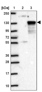 Western blot - Anti-WDR67 antibody (AB121771), expandable thumbnail